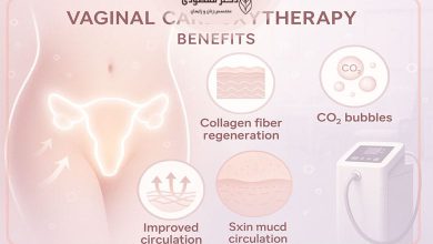 کربوکسی تراپی واژن