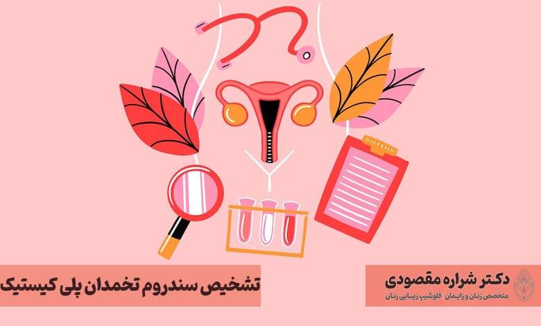نحوه تشخیص سندرم تخمدان پلی کیستیک