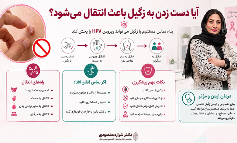 آیا دست زدن به زگیل باعث انتقال می‌شود؟