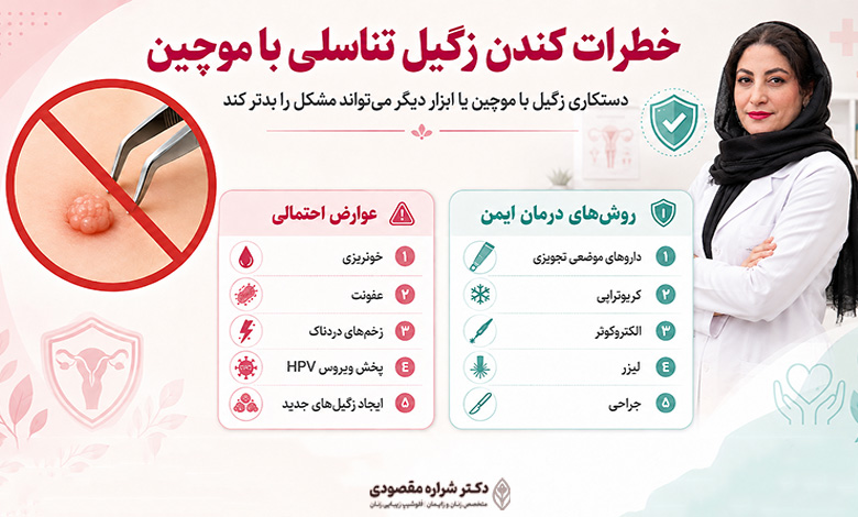 خطرات کندن زگیل تناسلی با موچین