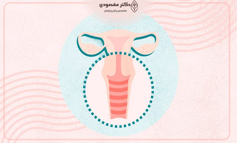 تاثیر موقتی و وابسته ساز