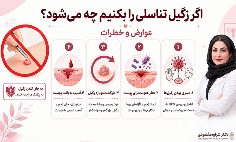 اگر زگیل تناسلی را بکنیم چه میشود؟