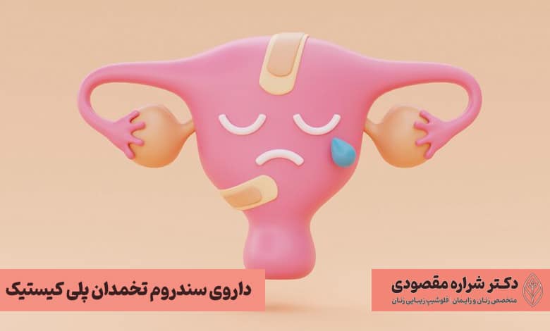 بهترین دارو برای سندرم تخمدان پلی کیستیک