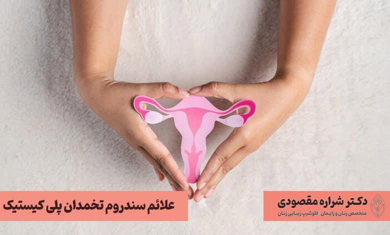 علائم و نشانه های سندرم تخمدان پلی کیستیک