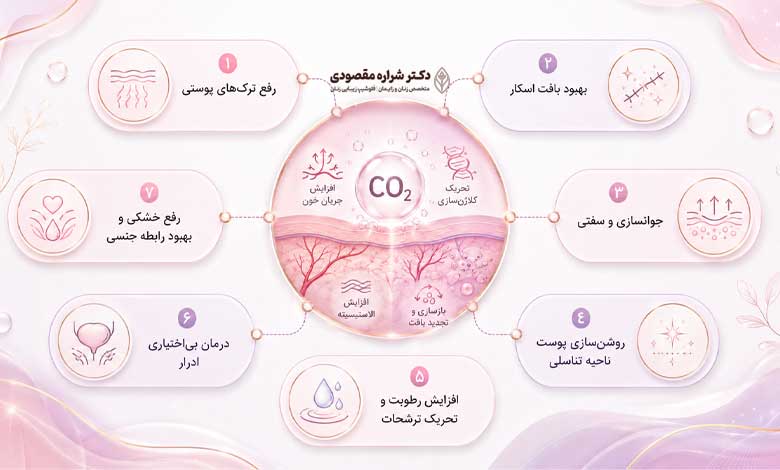 واژن