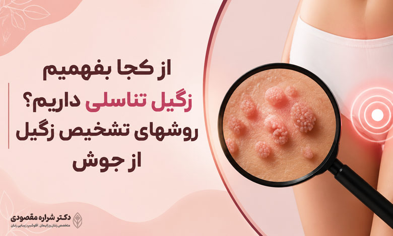 از کجا بفهمیم زگیل تناسلی داریم؟