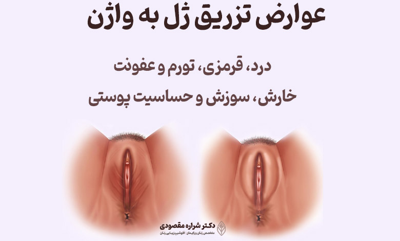 عوارض تزریق ژل به واژن