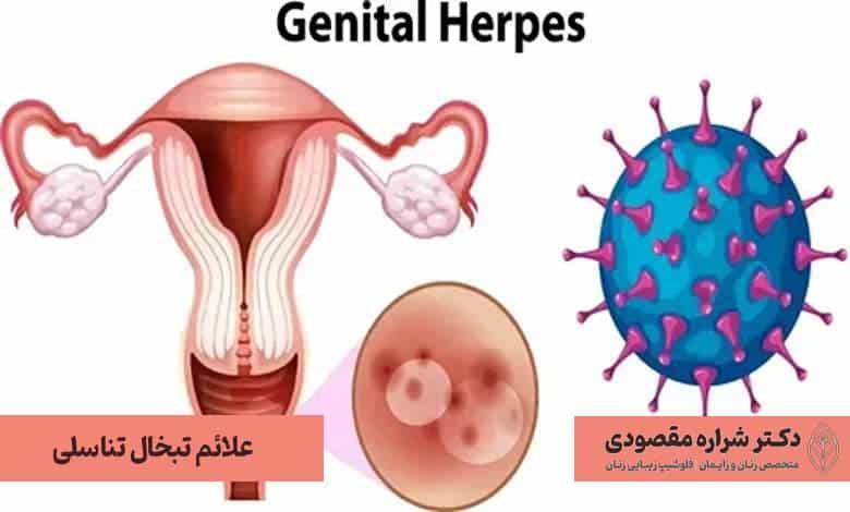 علائم تبخال تناسلی