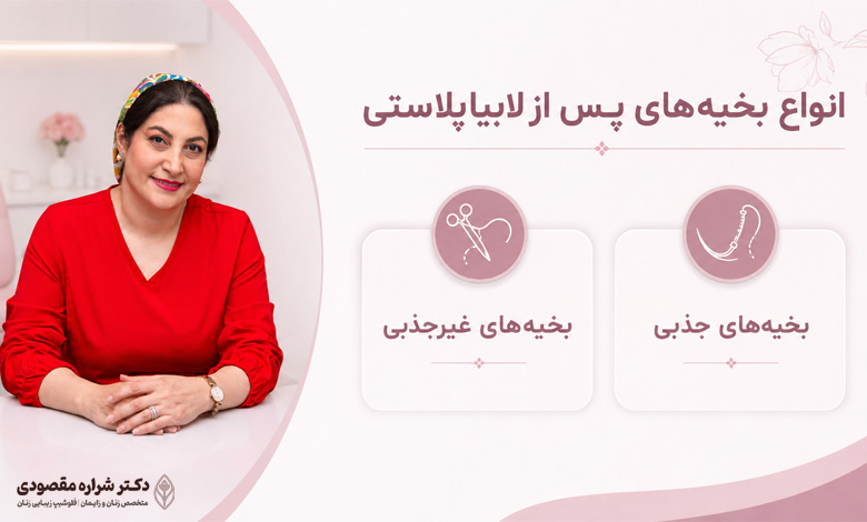 انواع بخیه‌های پس از لابیاپلاستی