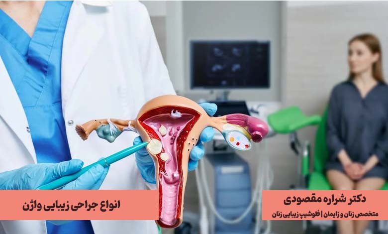 انواع روشهای جراحی زیبایی واژن