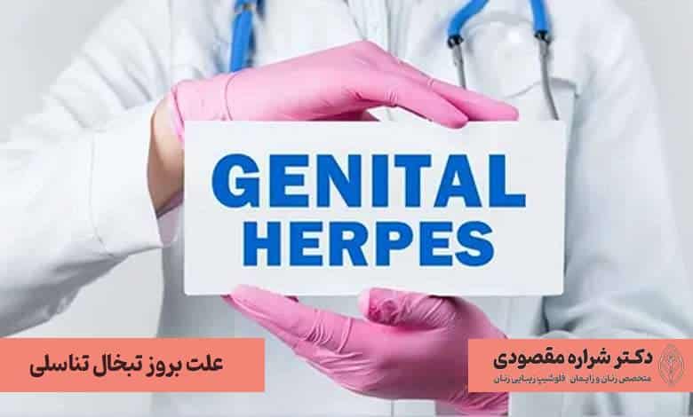 علت بروز تبخال تناسلی
