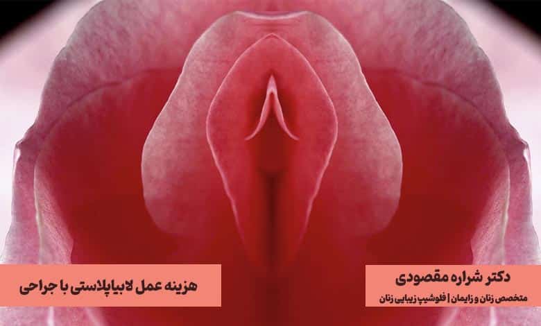 هزینه عمل لابیاپلاستی با جراحی