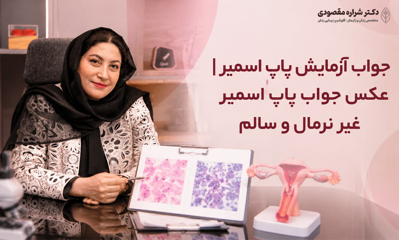 جواب آزمایش پاپ اسمیر