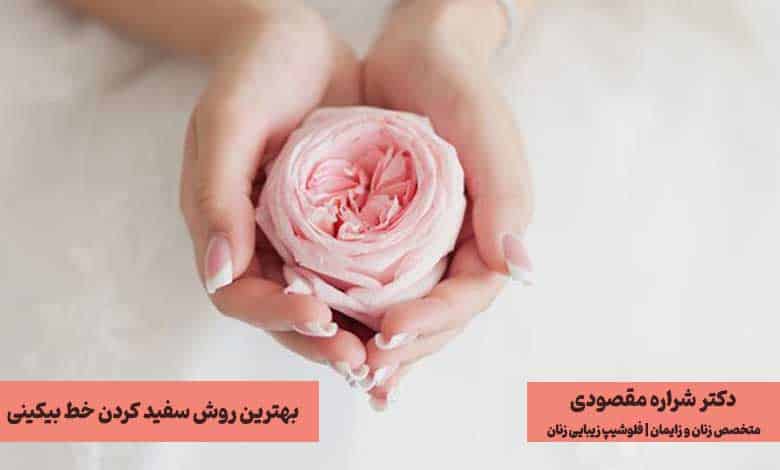 روشهای سفید کردن خط بیکینی
