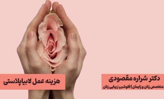 هزینه عمل لابیاپلاستی