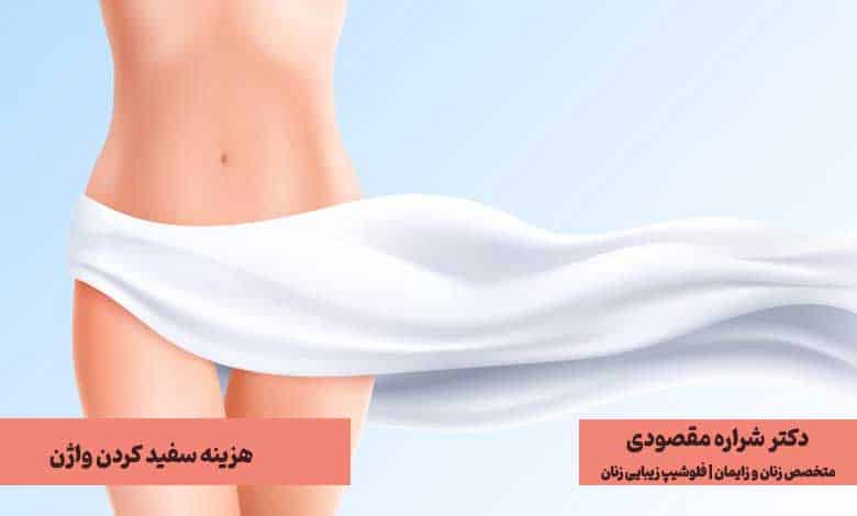 هزینه سفید کردن واژن