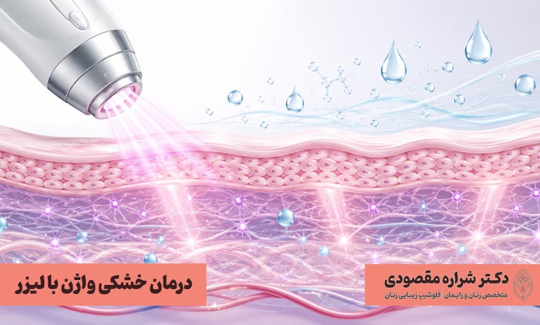 درمان خشکی واژن با لیزر