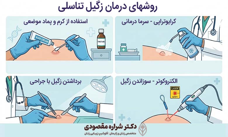 هزینه درمان زگیل تناسلی زنان