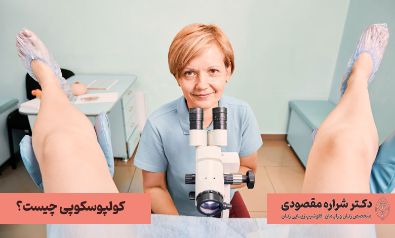 کولپوسکوپی