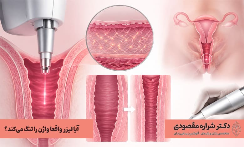 آیا لیزر واقعا واژن را تنگ میکند؟