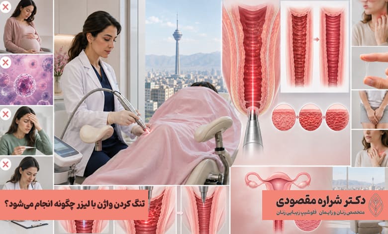 تنگ کردن واژن با لیزر چگونه انجام می‌شود؟