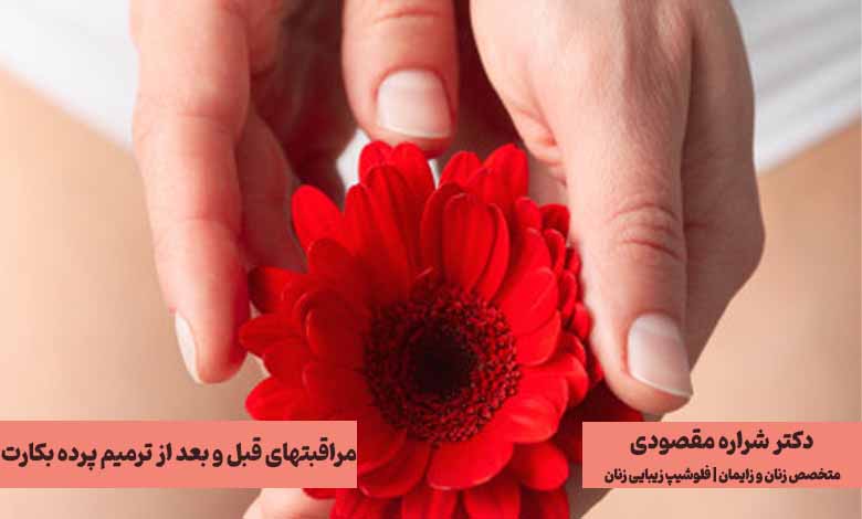 مراقبت های قبل و بعد از ترمیم پرده بکارت