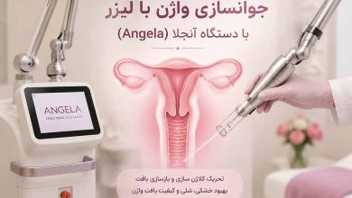 جوانسازی واژن با دستگاه لیزر آنجلا