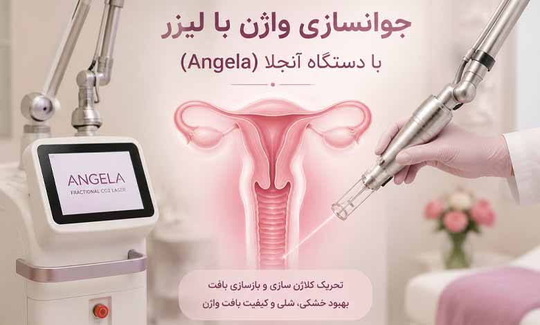 جوانسازی واژن با دستگاه لیزر آنجلا