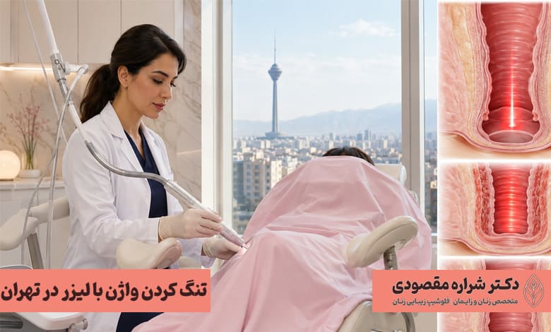 تنگ کردن واژن با لیزر در تهران