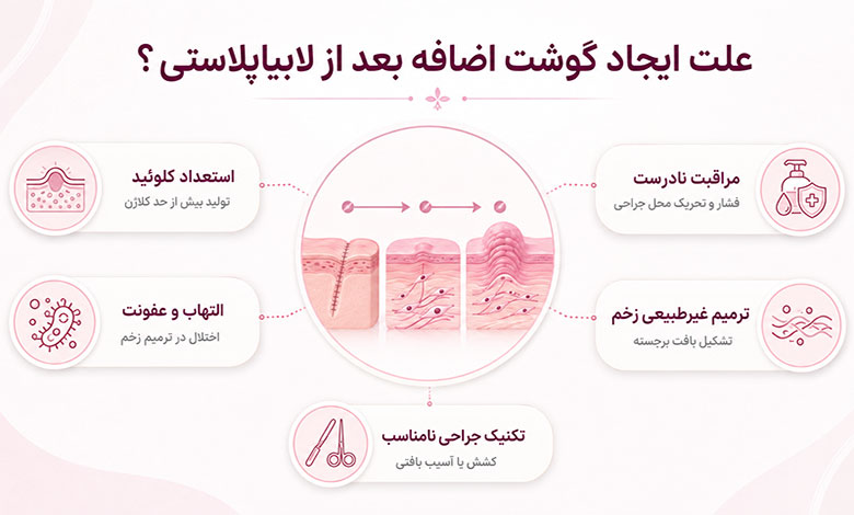 علت ایجاد گوشت اضافه بعد از لابیاپلاستی