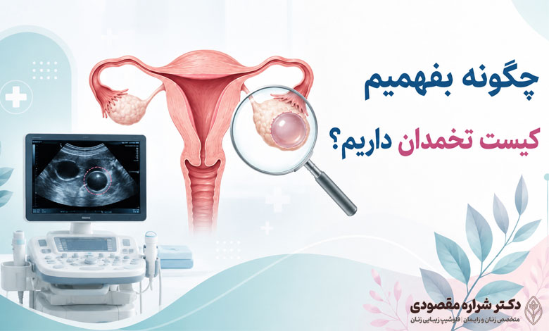 علائم کیست تحمدان چیست
