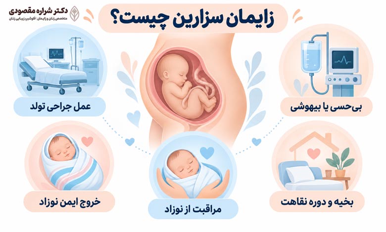 زایمان سزارین