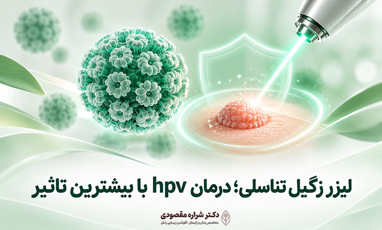 لیزر زگیل تناسلی