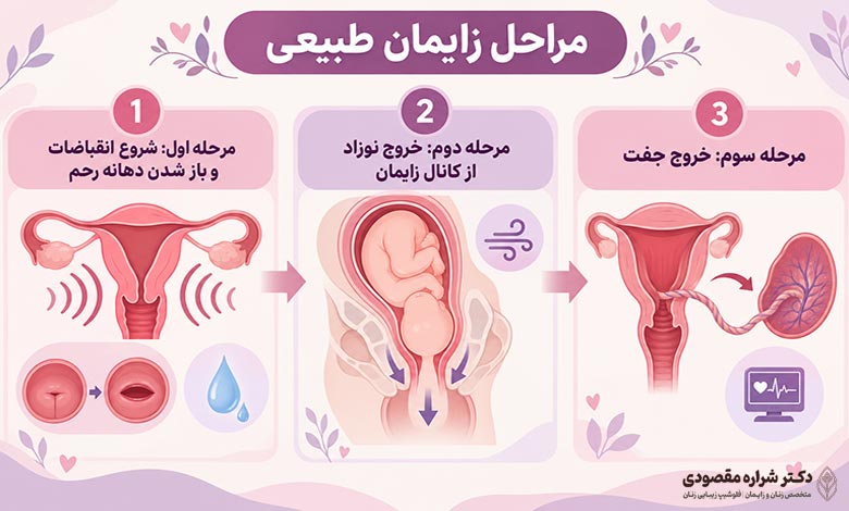 زایمان طبیعی چگونه انجام می­­شود