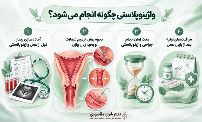 واژینوپلاستی چگونه انجام می ‌شود؟