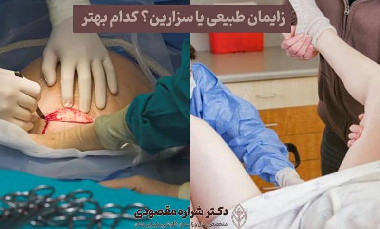 زایمان طبیعی یا سزارین؛ کدام روش بهتر است؟