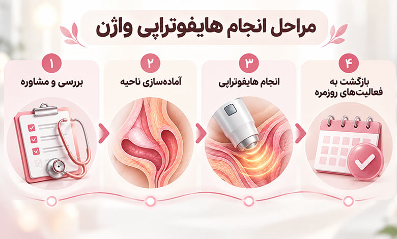 مراحل انجام هایفوتراپی واژن