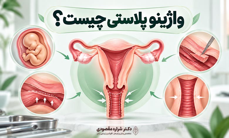 واژینوپلاستی چیست؟