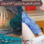 زایمان طبیعی یا سزارین؛ کدام روش بهتر است؟