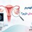 علائم کیست تحمدان چیست