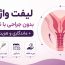 لیفت واژن بدون جراحی